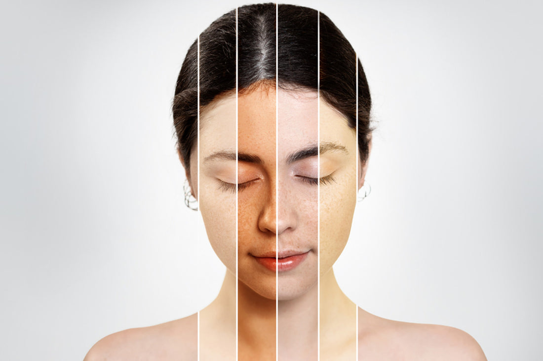 Skin-lightening