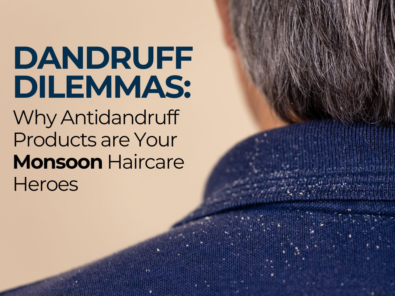 Dandruff Dilemmas: Why Anti Dandruff Products Are Your Monsoon Hair Care Heroes